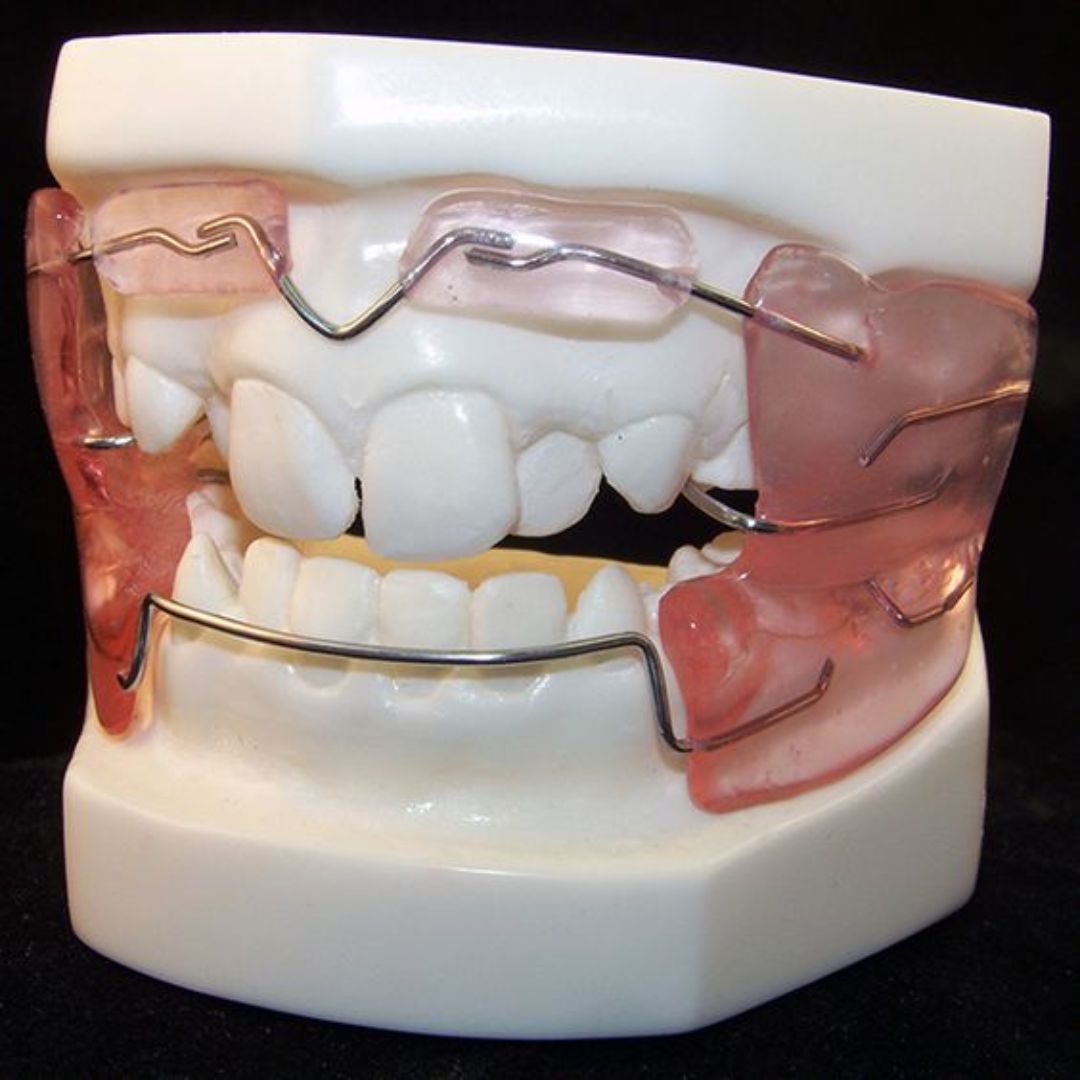 Removable Appliances Dental