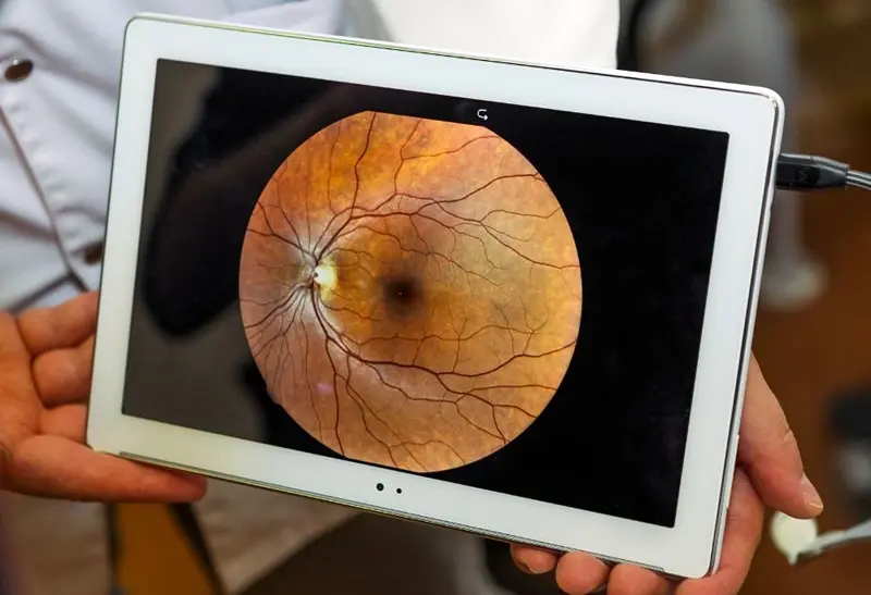 Retina Treatment