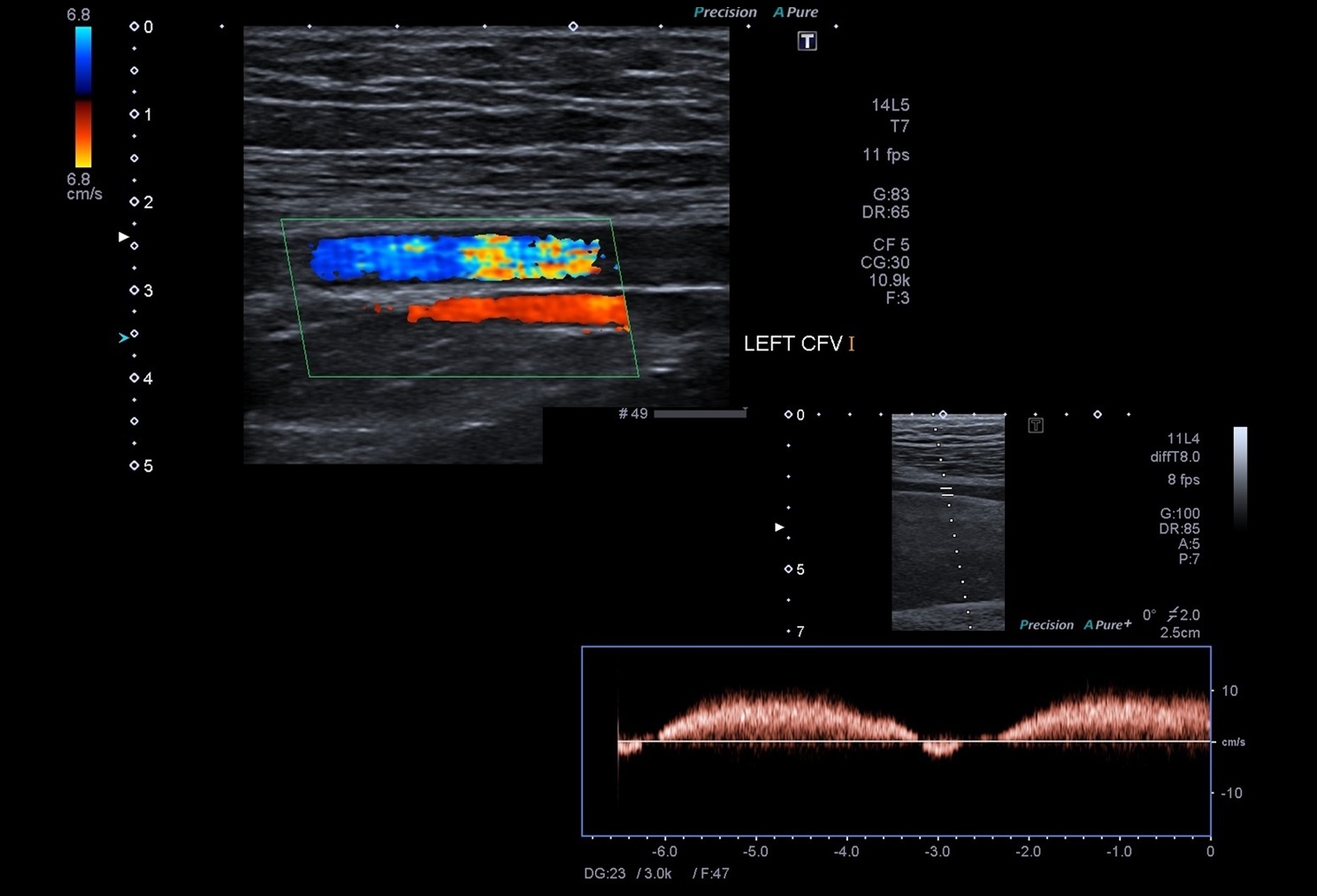 Doppler Ultrasound