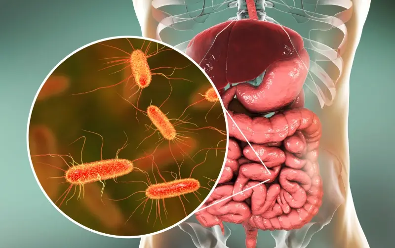 Small Intestinal Bacterial Overgrowth (SIBO)