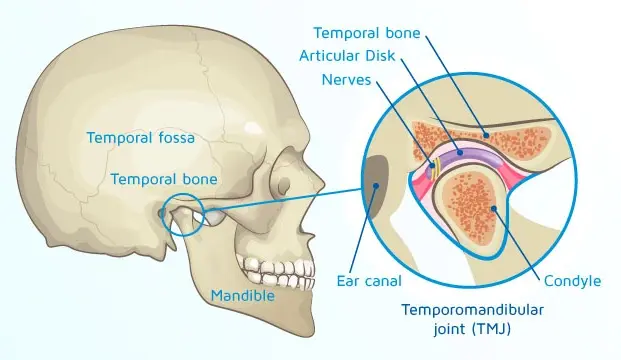 TMJ Dysfunction