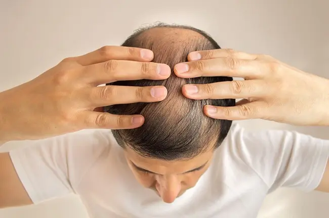 The Ultimate Guide to Hair Regrowth: From PRP to Advanced Regenerative Medicine