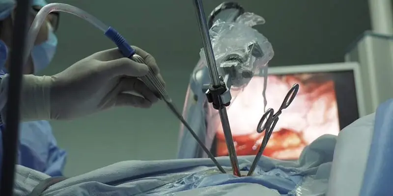 VATS Surgery