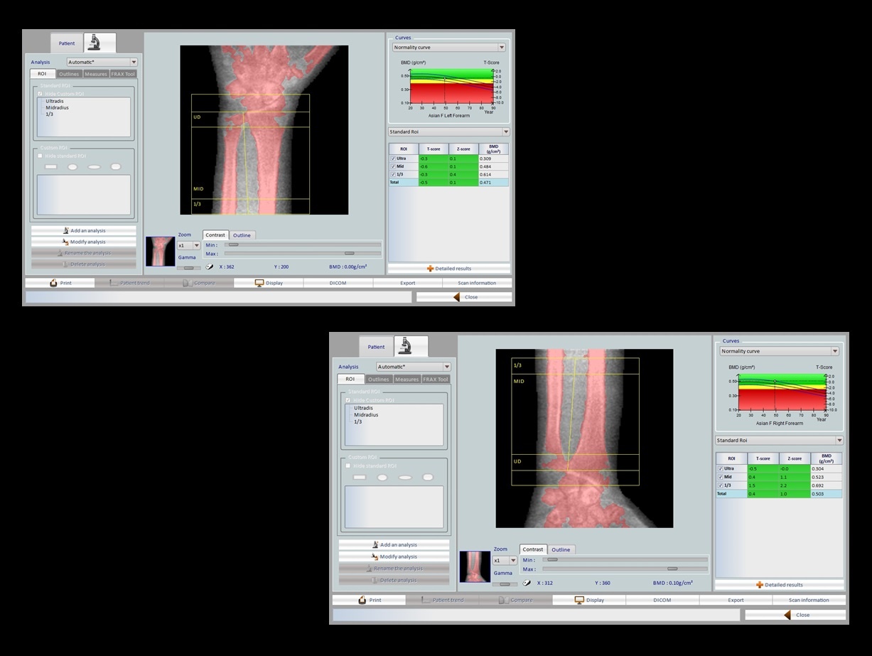 bmd_slide_4.jpg