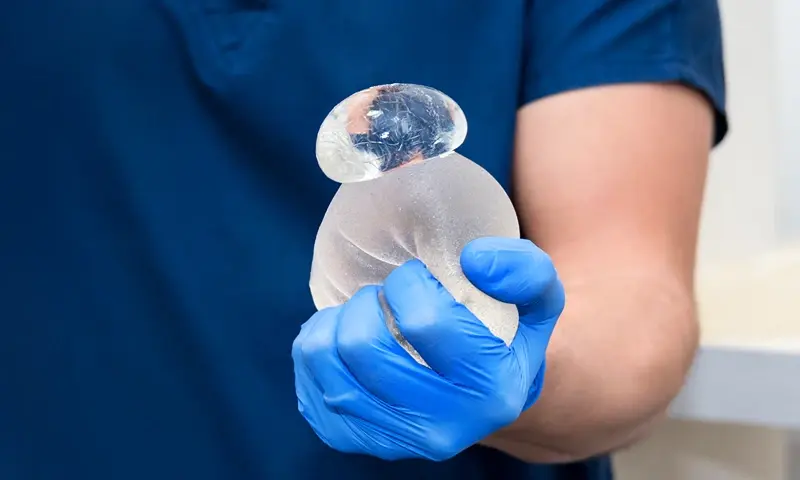 Breast Implant Removal