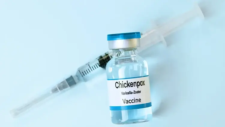 Chickenpox Vaccine