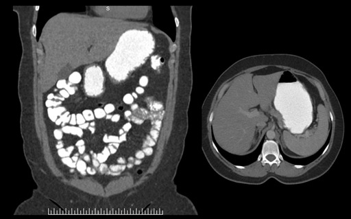 ct_slide_abdomen_1-1.jpg