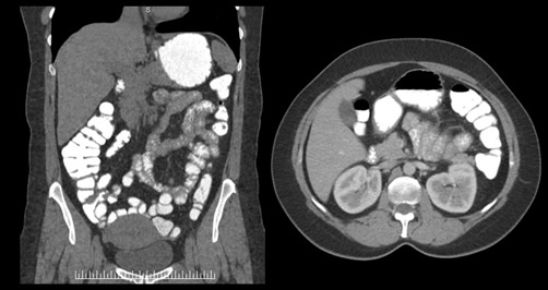 ct_slide_abdomen_2-2.jpg