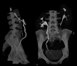 ct_slide_kub_3d-1.jpg