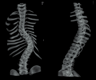 ct_slide_spine_3d-5.jpg