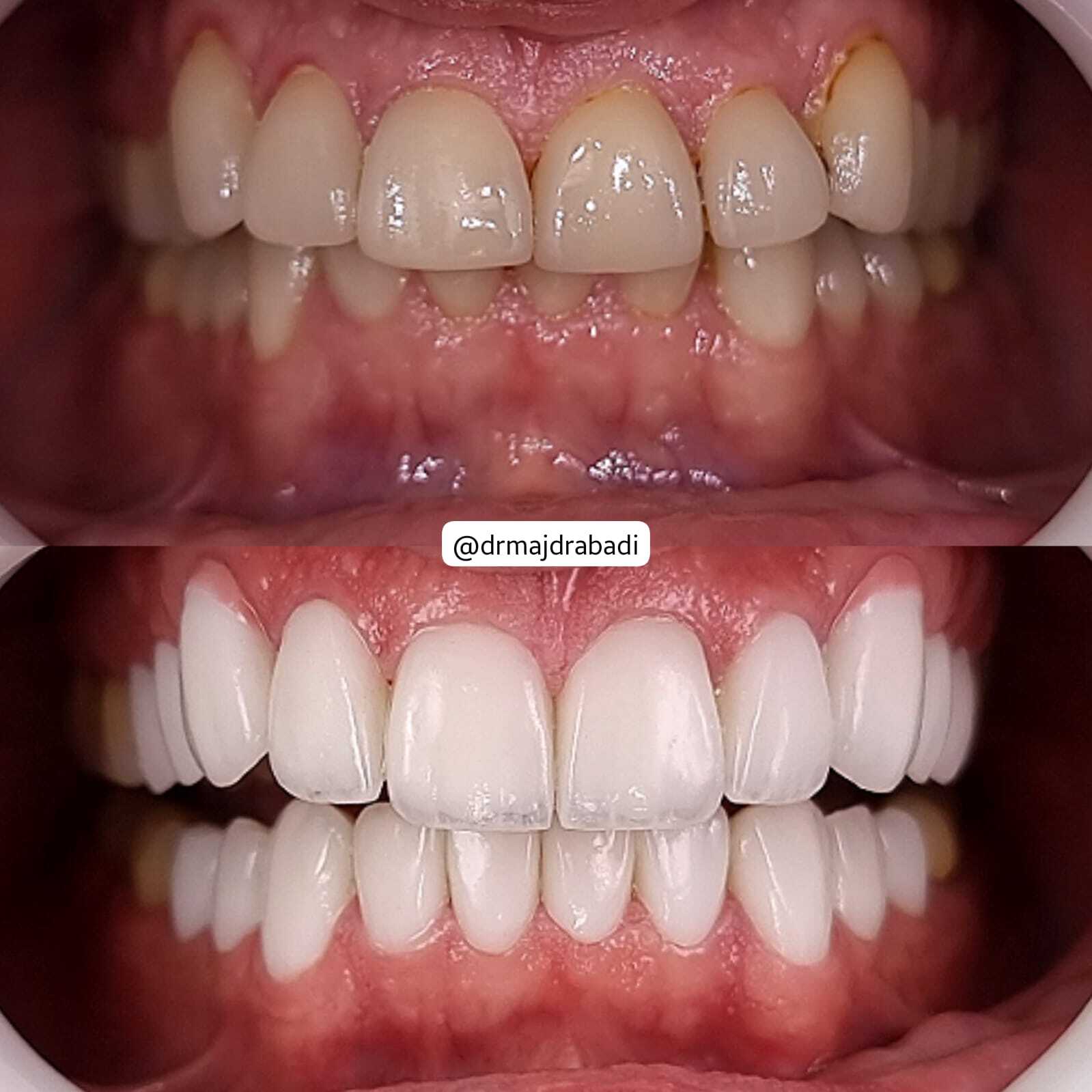 Dental