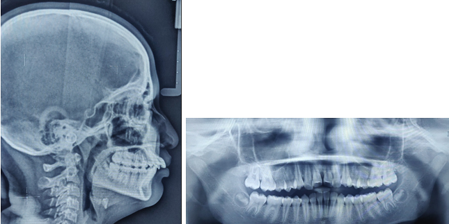 Dental Cephalograms