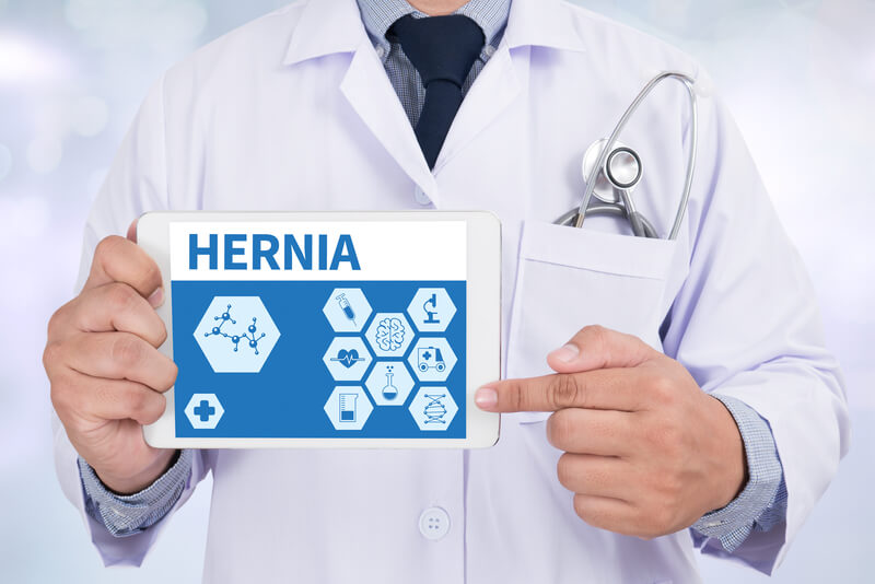 Ventral Hernia