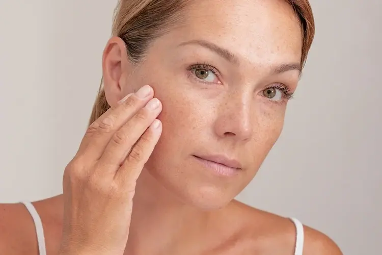 Freckles Sunspots Age Spots Removal