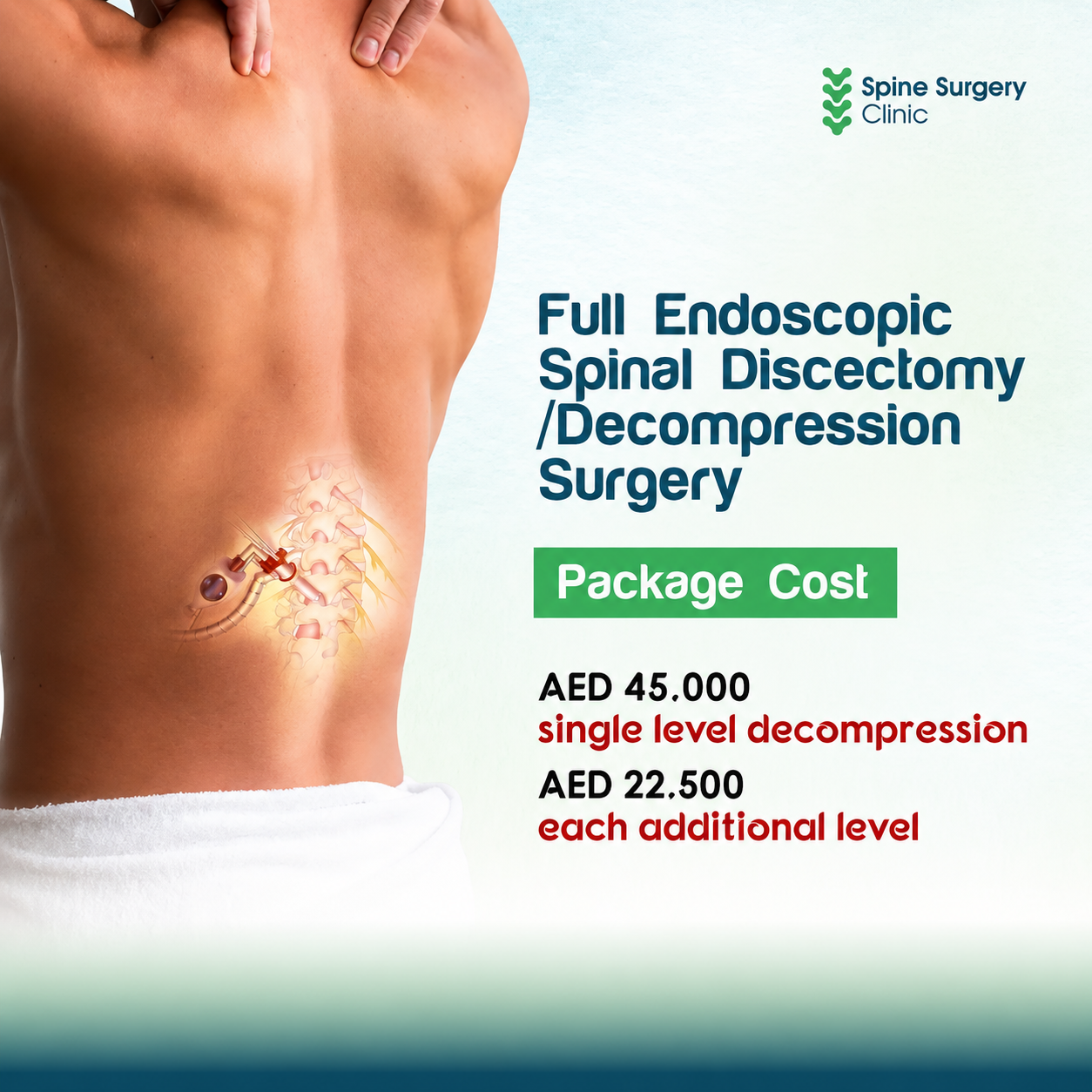 Full Endoscopic Discectomy Full Endoscopic Discectomy