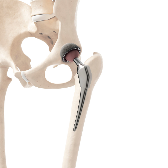 Hip Joint