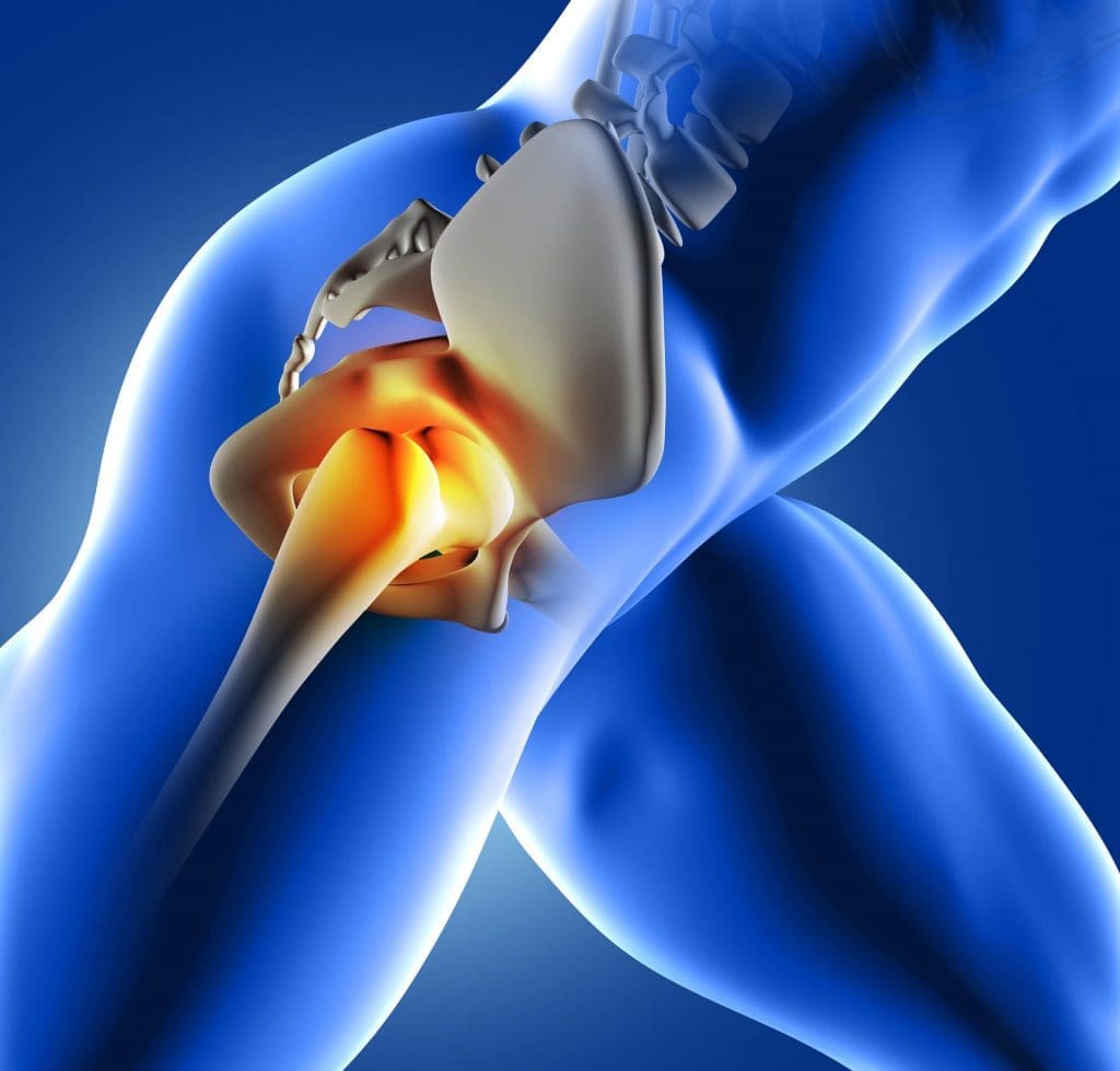 Hip Pain Treatment