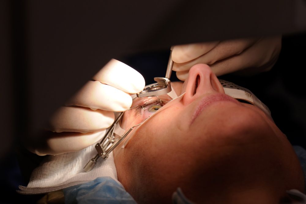 Intracorneal Ring Implantation cost