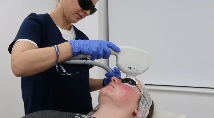 Laser Hyperpigmentation Treatment Dubai