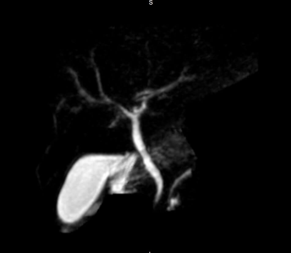 mrcp 4.jpg