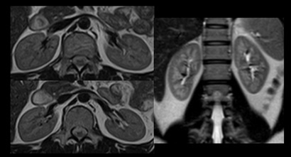 mri_kidney_slide_2.jpg