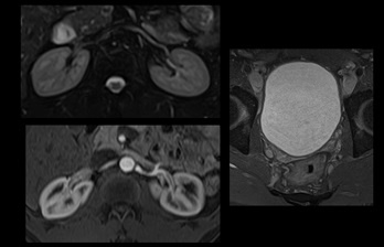 mri_kidney_slide_3-2.png