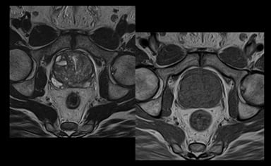 mri_slide_prostate_1-1.jpg