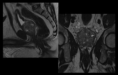 mri_slide_prostate_2-1.jpg