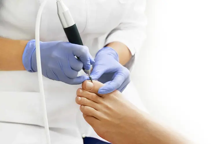 Nail Disorders Treatment in Dubai