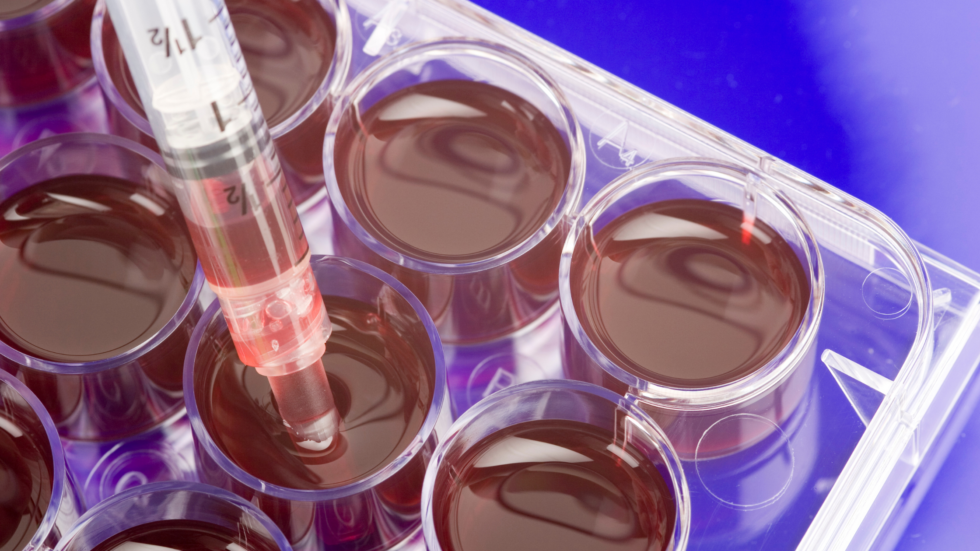 Orthobiologic Treatments