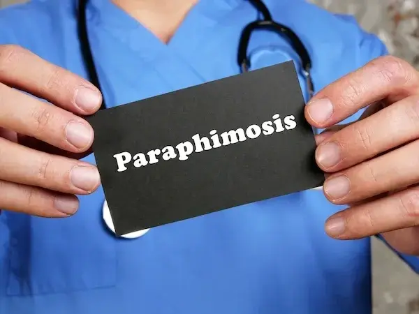 Paraphimosis