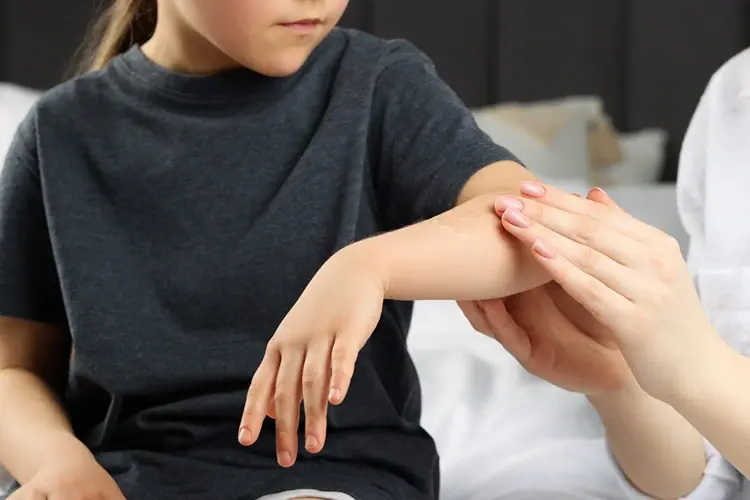 Pediatric Genetic Skin Conditions Dubai