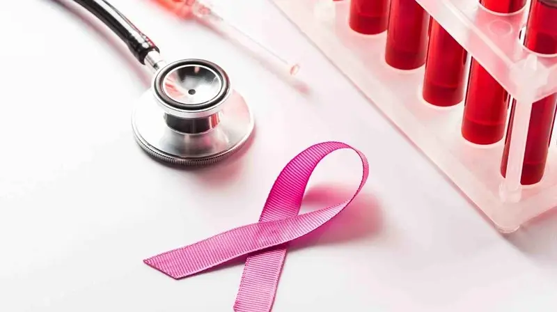 Sentinel Node Biopsy