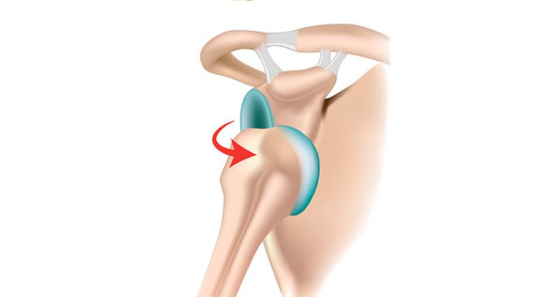 Shoulder Instability