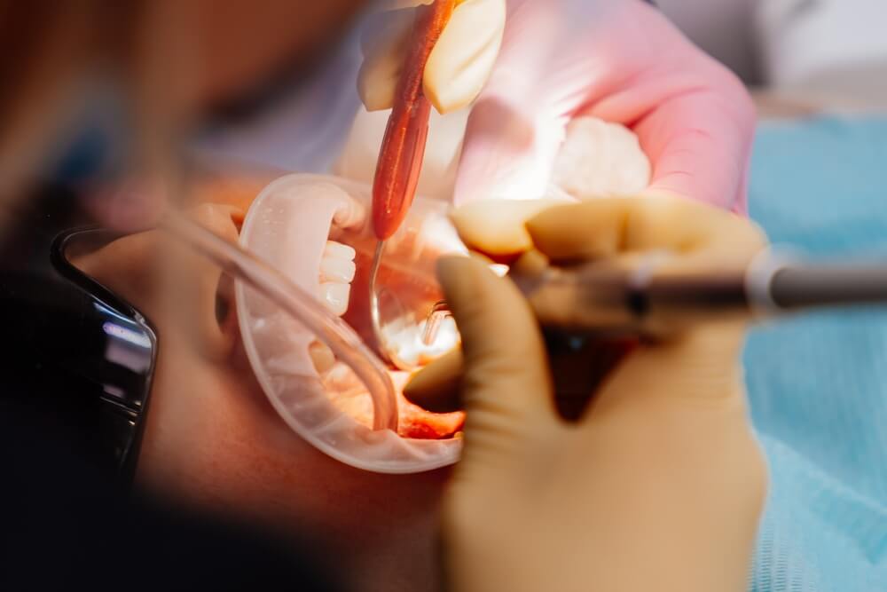 Dentures at best dental clinic