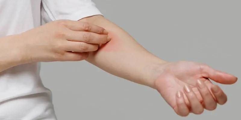 Soft Tissue Sarcoma