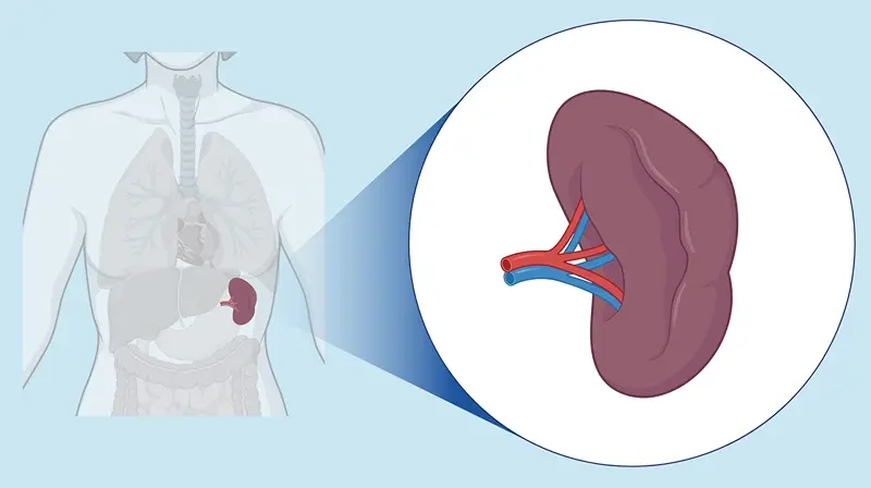 Spleen Surgery