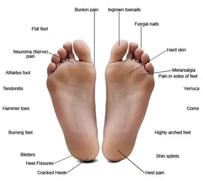 Toe Condition DRHC Dubai
