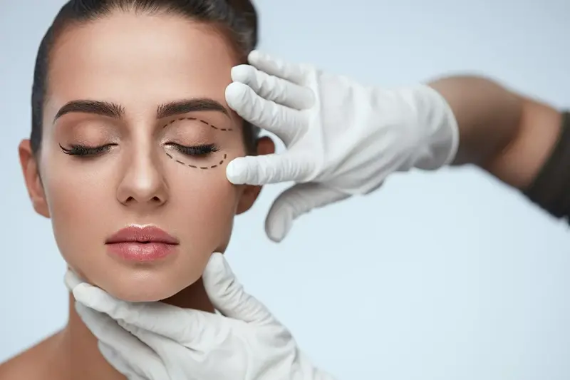 Upper Eyelid Surgery