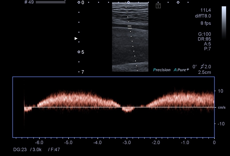 uts_doppler__3.jpg