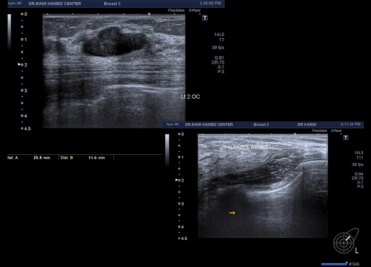 Ultrasonography